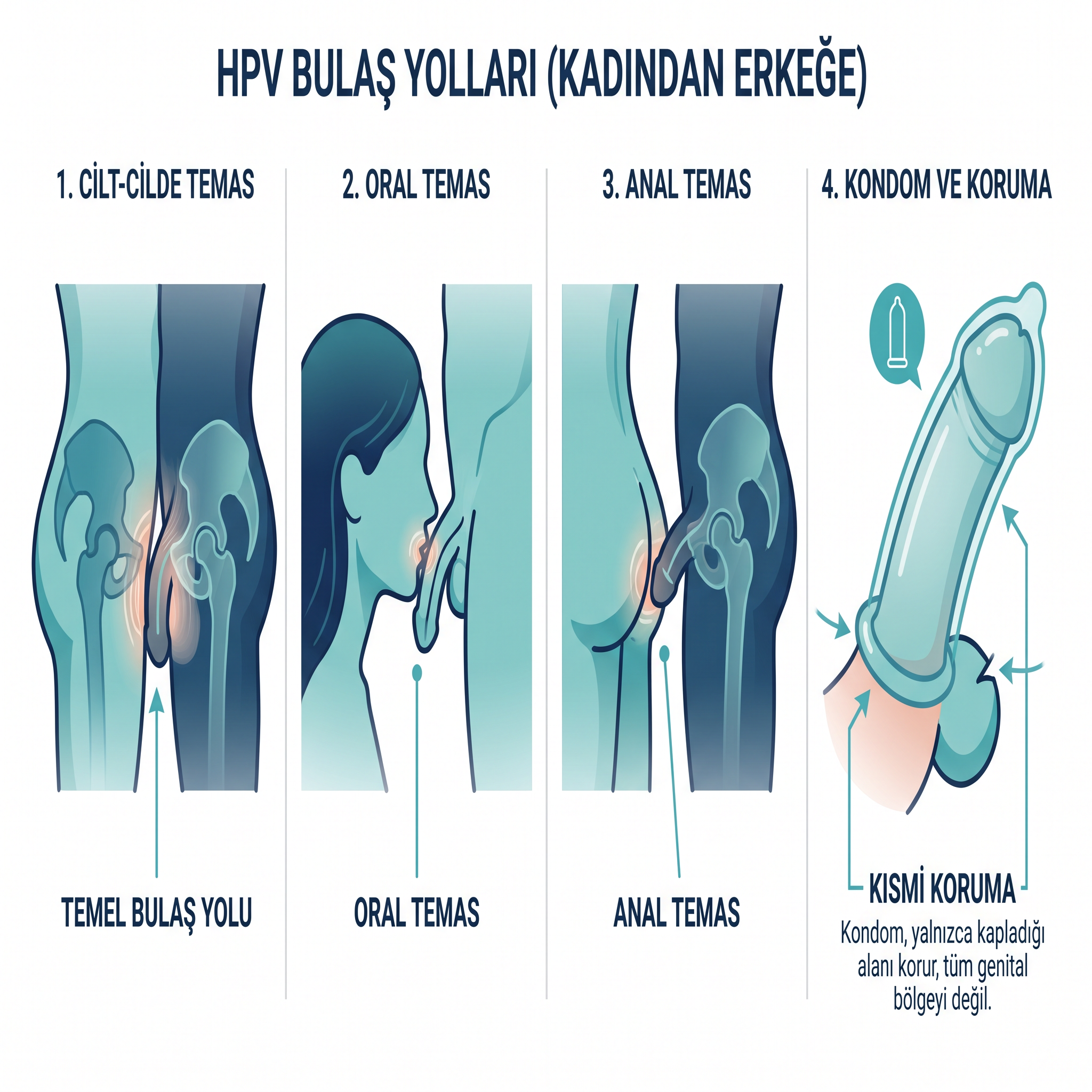 HPV Kadından Erkeğe Nasıl Bulaşır?