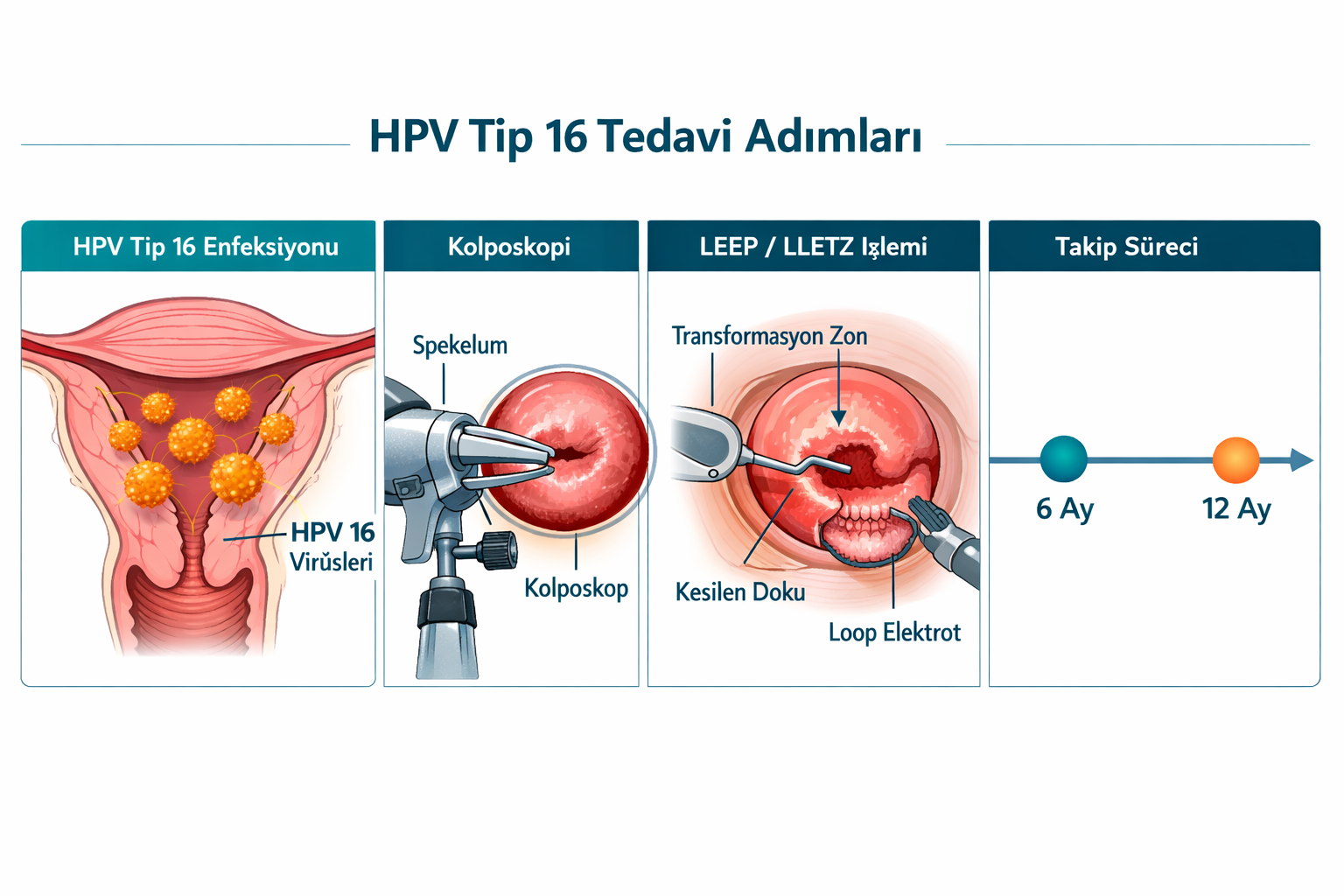HPV Tip 16 Nedir ve Neden Diğer Tiplerden Daha Tehlikelidir?